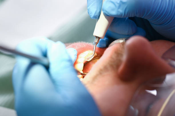 Best Weekend Emergency Dentist in Black Point Green Point, CA