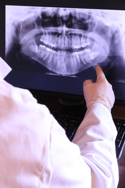 Best Emergency Tooth Extraction in Black Point Green Point, CA